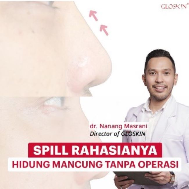 dr. Nanang Masrani Dokter Kulit Banjarmasin : Gambar dari Gloskin Instagram